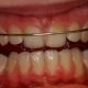 ortodonzia_2